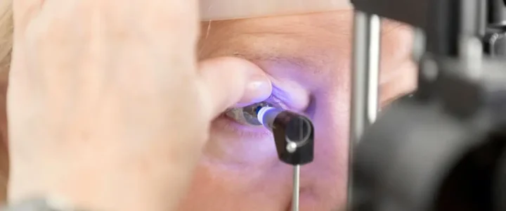 Retinopatia diabética: entenda condição ocular causada pelo diabetes